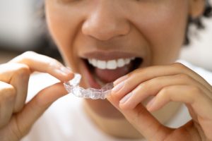 woman putting in clear aligners