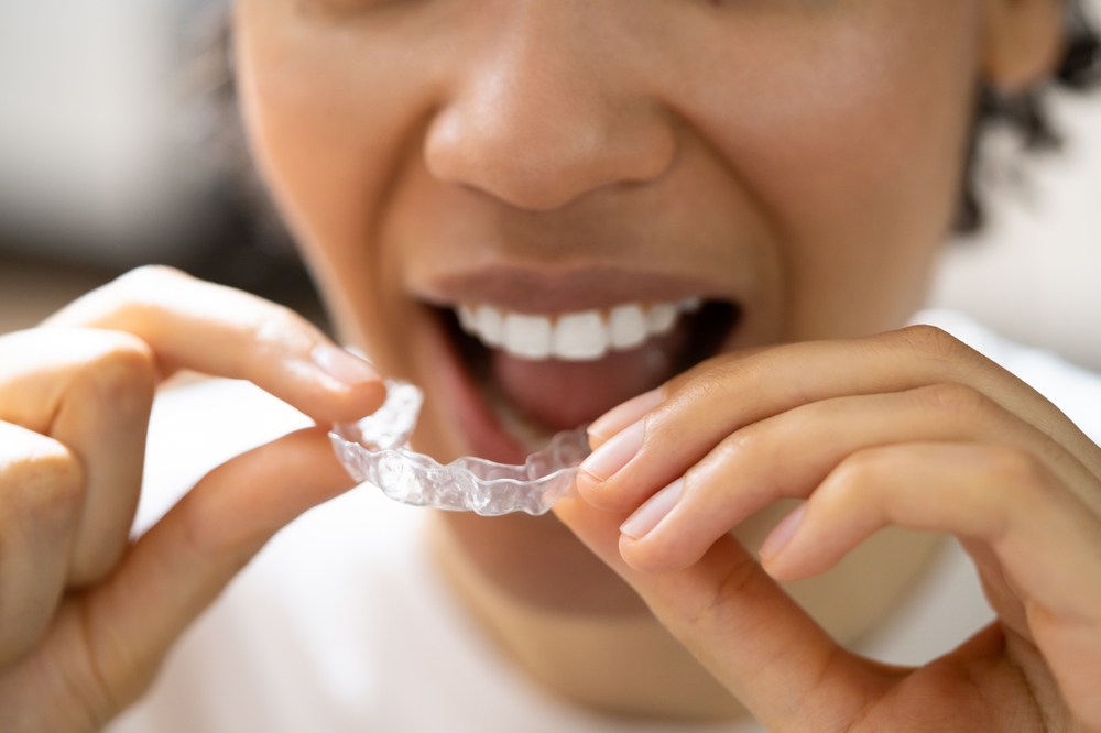 woman putting in clear aligners
